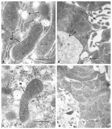 Immunocytochemical Localization Of Allantoinase In Lowicryl Embedded