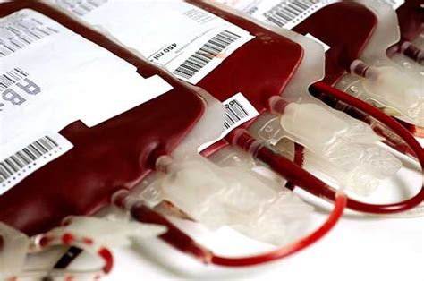 Quem Ja Teve Hepatite A Pode Doar Sangue - Quem já teve um diagnóstico de hepatite pode doar sangue? – Viva Mais ...