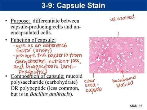 Bacterial Capsule Stain