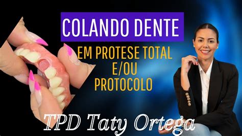 Como Colar Dente Na Pr Tese Total Youtube