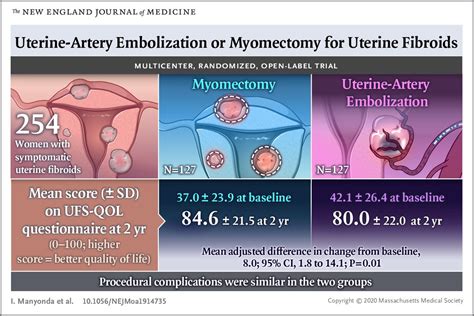 Fibroids and Pregnancy Archives - Houston Fibroids