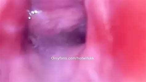 Pussy Camera Internal Creampie View XHamster