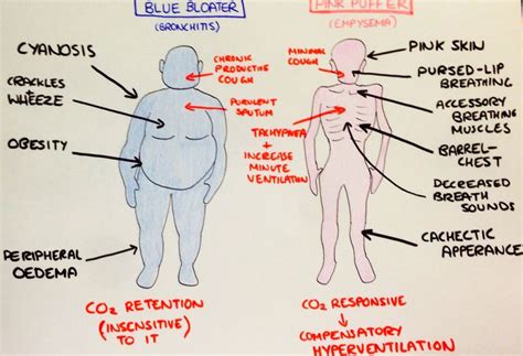 the diagram shows different types of human body