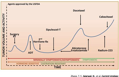 Treatment & Management of Prostate Cancer - CancerConnect