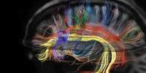 Image of the Day: Brain Wiring | The Scientist Magazine®