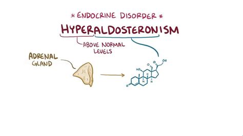 Conn Syndrome: What Is It, Causes, Symptoms, Diagnosis, Treatment, and ...