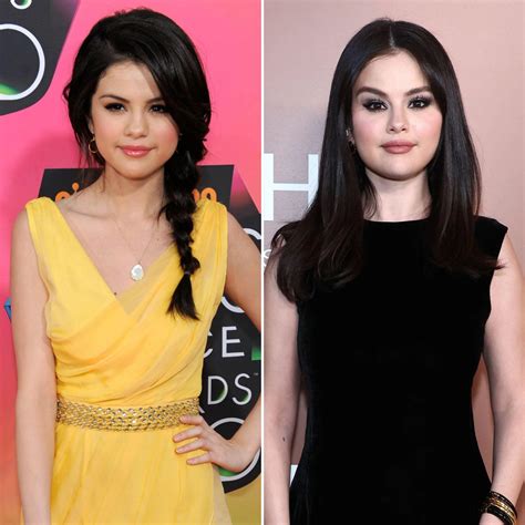 Selena Gomez Plastic Surgery: The Truth Behind Rumors