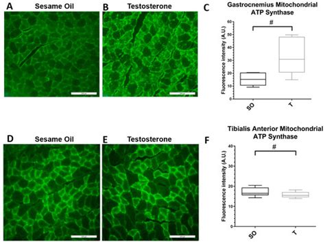 Ijms Special Issue Polycystic Ovary Syndrome From Molecular