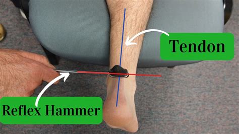 Ace Tips About How To Check Deep Tendon Reflexes Grantresistance