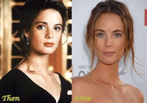 Celebplasticsurgerygossip: Gabrielle Anwar plastic surgery-she still ...