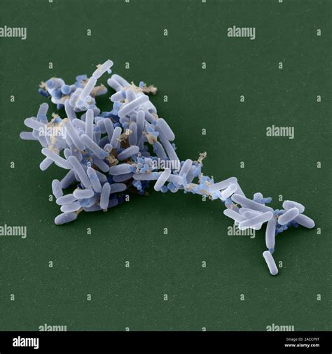 Bacillus pumilus, coloured scanning electron micrograph. B. pumilus are ...