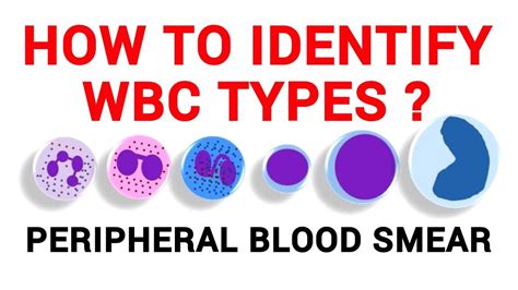 Wbc Identification Peripheral Blood Smear Haematology Lab