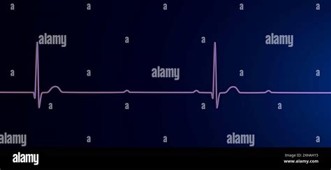 Illustration Of An Electrocardiogram Ecg Depicting A Complete Heart