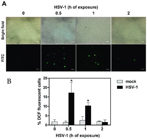 Ros Production In U937 Cells Exposed To Hsv 1 Cells Were Preloaded