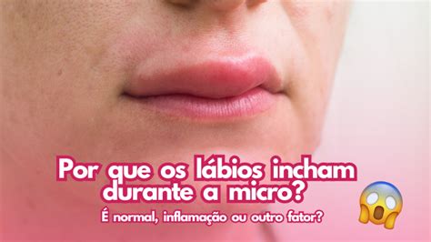 Grandes Lábios Inchados E Coçando - A micropigmentação causa inchaço nos lábios? Entenda a resposta ...