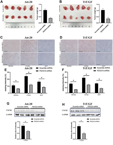 Pdcd Promotes The Aggressive Behaviors Of Pituitary Adenomas By Up