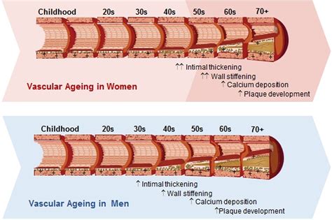 Treating Vascular Aging Cvd Part El Paso Tx Health Coach Clinic