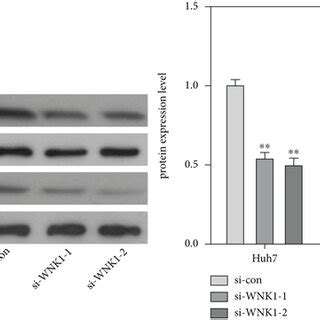 Wnk Was Highly Expressed In Hcc Cell Lines And Promoted Cell Growth