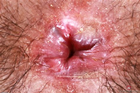 Atk Hairy Featuring Hazel Heart Porn Photos Coedcherry