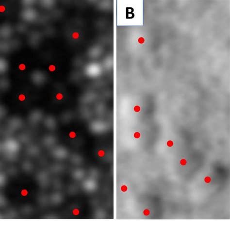 Cellular imaging with adaptive optics scanning light ophthalmoscopy ...
