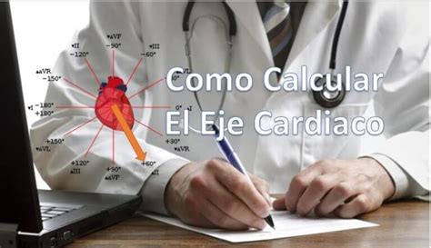 Electrocardiograma Cerebromedico