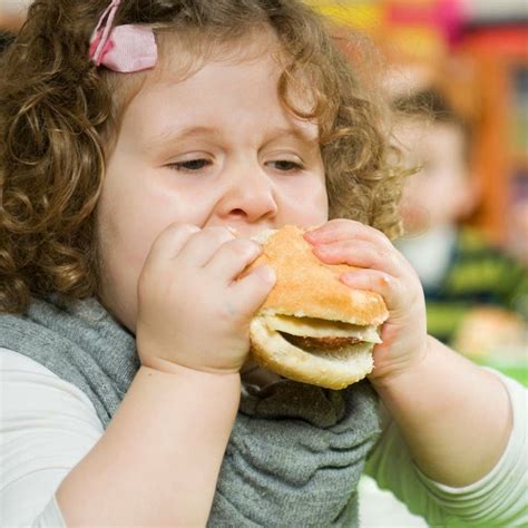 Obesidade Infantil Cuidados Na Alimenta O Pode Evitar O Problema