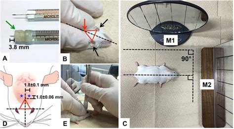 Intracerebroventricular Injection Of Amyloid Peptides In Normal Mice