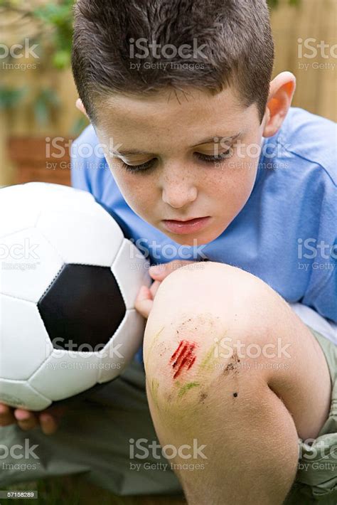 Boy With Grazed Knee Stock Photo Download Image Now Child Physical