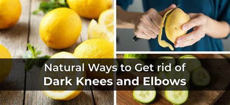 Dark Knees and Elbows: 10 Natural Treatments to Dark, Rough Skin Around Elbows and Knees