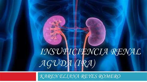 Insuficiencia Renal Aguda Ppt