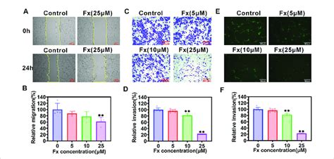 Fx Inhibits Migration Invasion And Transendothelial Migration Of Download Scientific Diagram