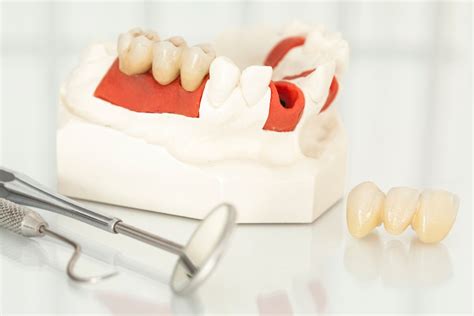 Cracked Tooth Or Large Filling 5 Signs You Need A Dental Crown