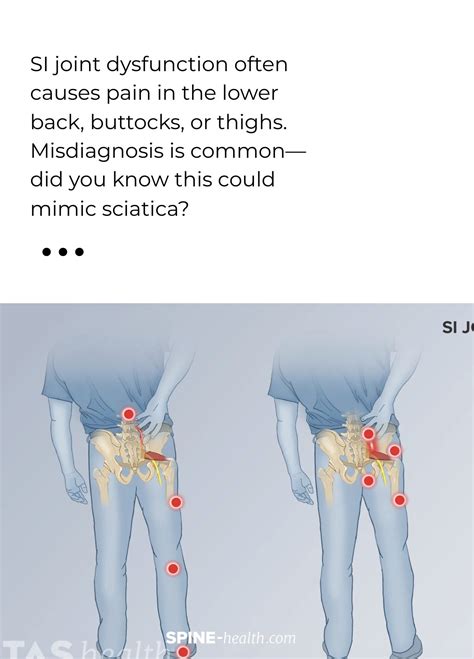 Spine-health | Facebook