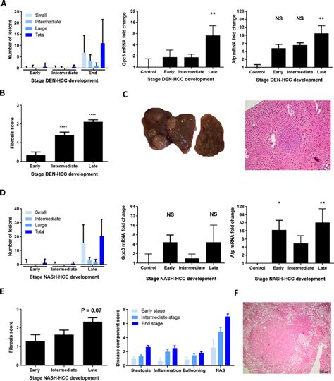 Clinicopathological Features Of Den And Nash Induced Hcc Development