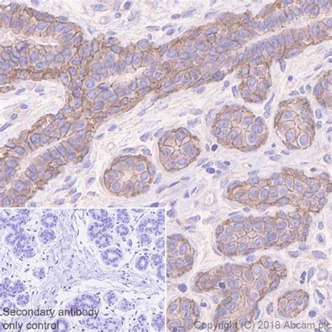 Anti P Cadherin Antibody EPR22426 BSA And Azide Free Ab245204 Abcam