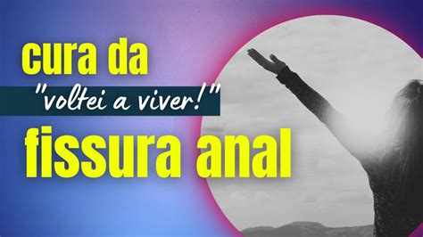 Fissura Anal DEPOIMENTO De Cura YouTube