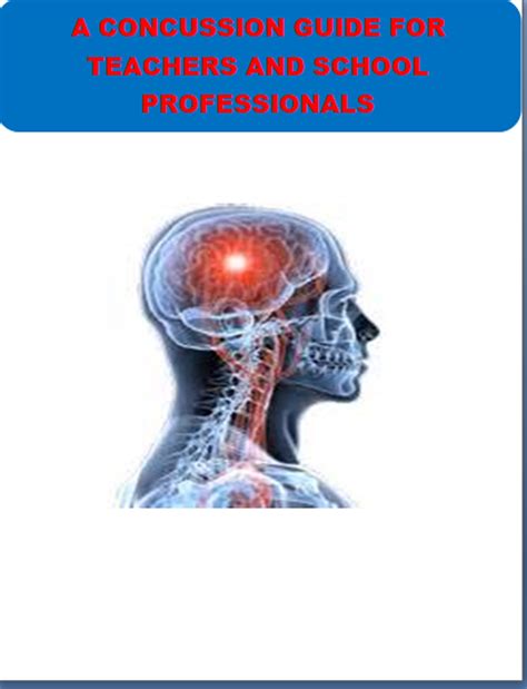 Concussion Guide for Teachers and Administrators - Amped Up Learning