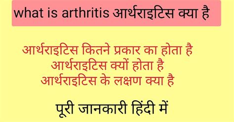 Arthritis Kya Hai आर्थराइटिस क्या हैक्यों होता है लक्षणप्रकार और बचाव