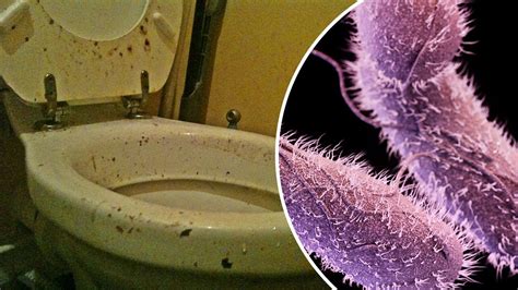 You're getting germs from everyone's poop on your phone; Flesh eating ...