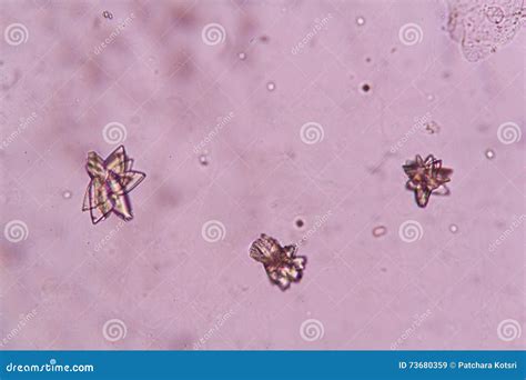 Urine Crystals, Red Blood Cells And Leukocytes At The Microscope. Urinary Tract Disease In Cat ...