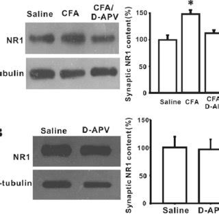 Nmda Increased The Synaptic Expression Of Nr In Spinal Dorsal Horn Of