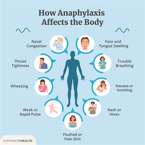 Anaphylaxis Causes And Triggers Foods Medications Insect Stings