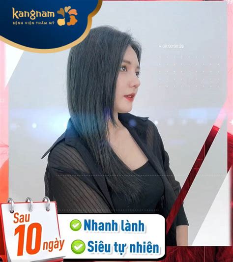 Hot Girl 2k1 lột xác thành nàng thơ nhờ nâng mũi