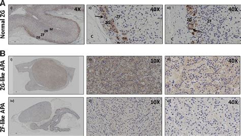 Nefm Neurofilament Medium Polypeptide A Marker For Zona Glomerulosa