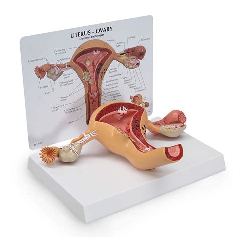 Female Reproductive Model Labeled