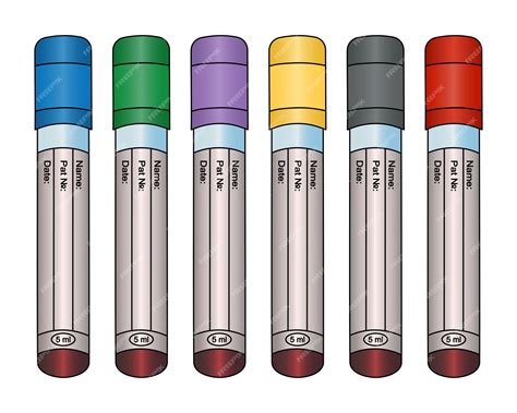 Conjunto De Tubos De Ensayo Con Análisis De Sangre De Pacientes En Estilo De Dibujos Animados