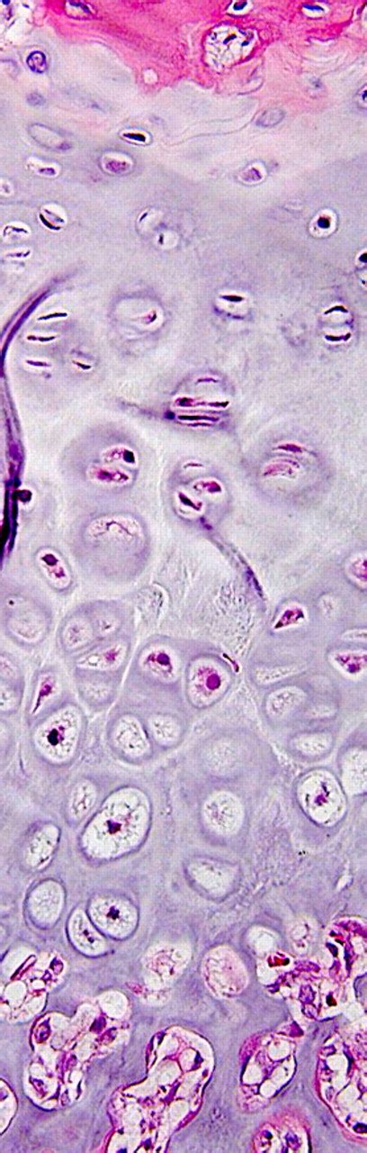 The Role Of Sex Hormones In The Kinetics Of Chondrocytes In The Growth