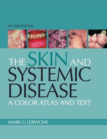 The Skin And Systemic Disease A Color Atlas And Text Lebwohl MD Dr