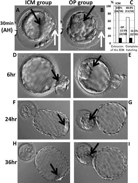 Relevance Of The Site Of Assisted Hatching In Thawed Human Blastocysts A Preliminary Report