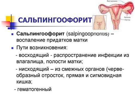 Воспаление придатков у женщин: причины, признаки, диагностика и лечение
